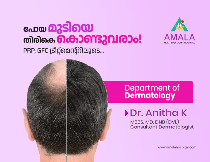 Dermatology Department at Amala Hospital Mobile